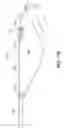 Fig. 20 - Flexible Wind Turbine Apparatus