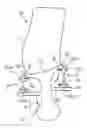 Fig. 01 - Rotor in blisk or bling design of an aircraft engine
