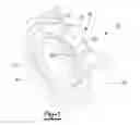 Fig. 02 - SURFACE TREATED BEARING COMPONENT