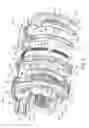 Fig. 02 - Expandable piston assembly