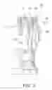 Fig. 04 - Hydraulic power transmission device