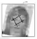 Fig. 01 - Recovering planar projections