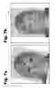 Fig. 08 - Recovering planar projections