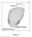 Fig. 07 - Medical image processing apparatus and analysis region setting method of texture analysis