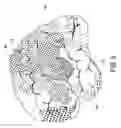 Fig. 09 - Medical image processing apparatus and analysis region setting method of texture analysis