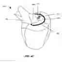 Fig. 09 - System and method for performing virtual surgery