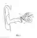 Fig. 02 - Removable middle ear implant sensor