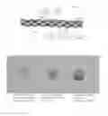 Fig. 02 - LAMELLAR CORNEA PRESERVATION SOLUTION