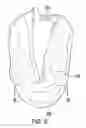 Fig. 06 - Scarf and Pocket Combination Assembly