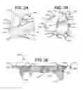 Fig. 06 - Cleats, Cleated Sole Structures, Molds and Molding Methods for In-Molding Articles