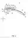 Fig. 04 - Clasp, watch band, and watch