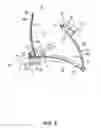 Fig. 09 - Clasp, watch band, and watch