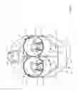 Fig. 22 - Hand carryable surface cleaning apparatus