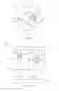 Fig. 07 - ESOPHAGEAL MARKING, OCT METHOD, AND TREATMENT METHOD USING MARKS