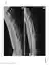 Fig. 09 - Optical coherence tomography system including a planarizing transparent material