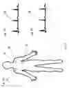 Fig. 08 - Sensing circuit with cascaded reference