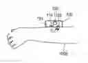 Fig. 01 - OPTICAL VITAL SIGNS SENSOR