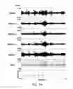 Fig. 09 - System and method for non-invasively monitoring autonomic nerve activity