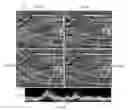 Fig. 07 - Apparatus for ultrasound flow vector imaging and methods thereof