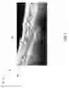 Fig. 06 - SYSTEMS FOR ULTRASOUND IMAGING