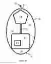Fig. 07 - Sampling device capable of continuously sampling content in a biological conduit and method thereof