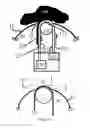 Fig. 08 - Sampling device capable of continuously sampling content in a biological conduit and method thereof