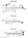 Fig. 06 - Soft tissue fixation repair methods using tissue augmentation constructs