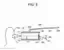 Fig. 07 - Soft tissue fixation repair methods using tissue augmentation constructs