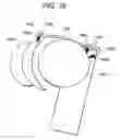 Fig. 32 - Soft tissue fixation repair methods using tissue augmentation constructs