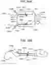 Fig. 74 - Soft tissue fixation repair methods using tissue augmentation constructs