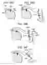 Fig. 75 - Soft tissue fixation repair methods using tissue augmentation constructs