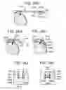 Fig. 76 - Soft tissue fixation repair methods using tissue augmentation constructs