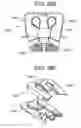 Fig. 89 - Soft tissue fixation repair methods using tissue augmentation constructs