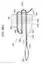 Fig. 90 - Soft tissue fixation repair methods using tissue augmentation constructs