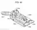 Fig. 97 - Soft tissue fixation repair methods using tissue augmentation constructs