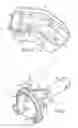 Fig. 06 - Devices and methods for surgical suturing