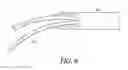 Fig. 08 - Suture capture device and method of capturing a suture