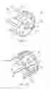 Fig. 02 - ORTHOPEDIC BONE STAPLE WITH POLYAXIAL COMPRESSION CAPABILITY