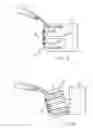 Fig. 06 - ORTHOPEDIC BONE STAPLE WITH POLYAXIAL COMPRESSION CAPABILITY