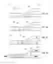 Fig. 09 - Methods of use of a balloon-tip aspiration catheter for ischemic stroke interventions