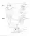 Fig. 07 - Surgical templates