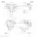 Fig. 28 - Surgical templates