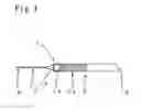 Fig. 02 - DEVICE FOR REMOVING A THROMBUS FROM A RETINAL VESSEL