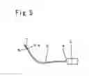 Fig. 06 - DEVICE FOR REMOVING A THROMBUS FROM A RETINAL VESSEL