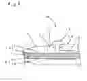 Fig. 07 - DEVICE FOR REMOVING A THROMBUS FROM A RETINAL VESSEL