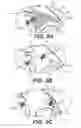 Fig. 07 - Medical device and methods of use