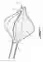 Fig. 08 - SPECIMEN RETRIEVAL DEVICE, METHOD AND KIT