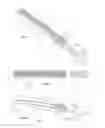 Fig. 02 - Manual debridement implement