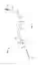 Fig. 02 - Thermoform cannula with variable cannula body stiffness