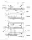 Fig. 03 - Laparoscopic port